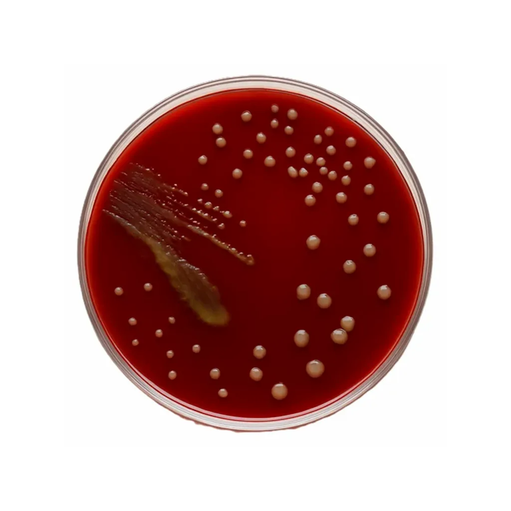 [CMP0100311] CREATIVE BLOOD AGAR PLATE